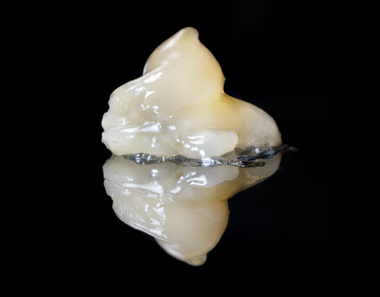 Fresh Frozen Cannabis: How Live Rosin Is Made and Why It Costs So Much